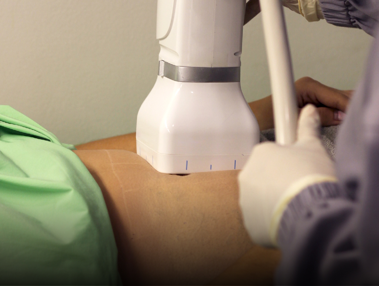 image of LipoStripping