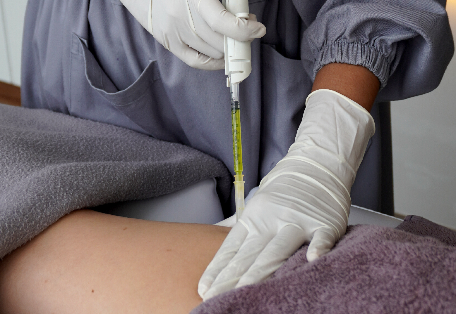 image of LipoBurn